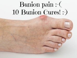 How to Get Rid of Bunions
