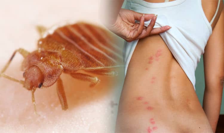 4 Signs of Bed Bugs and a Remedy for Bug Bites - HopingFor ...